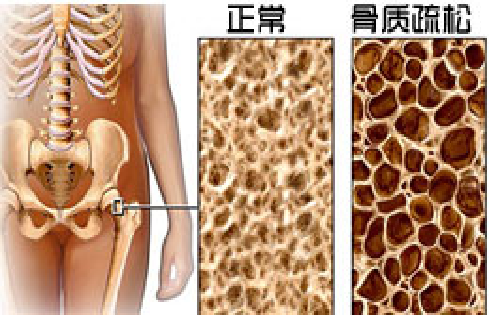 15381882628283216.png 15381882628283216.png